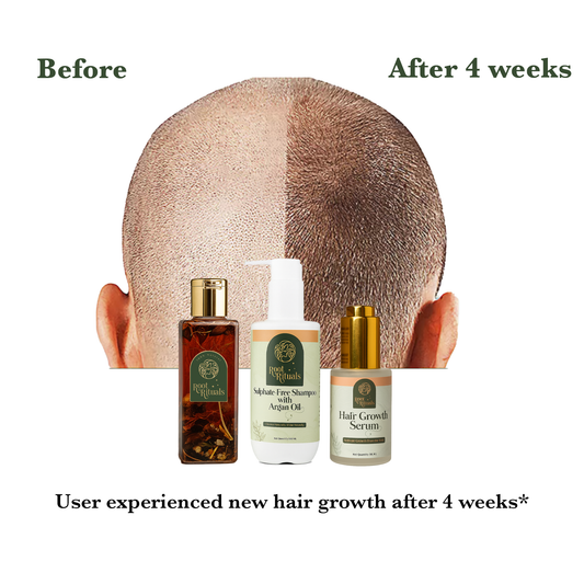 Root Rituals Hair Growth Kit | hair Oil, Shampoo & Serum Combo