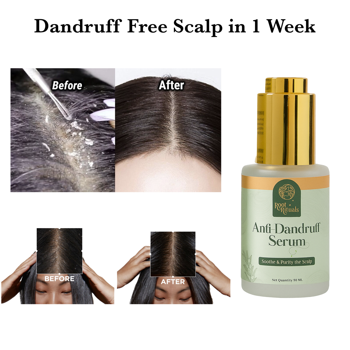 RootRituals Anti Dandruff Leave-in serum to fight dandruff, reduce flakes, and calm irritation.