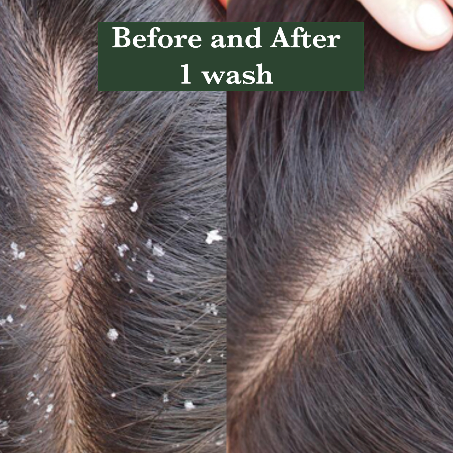 RootRituals Anti dandruff Shampoo with Tea Tree & Zinc.