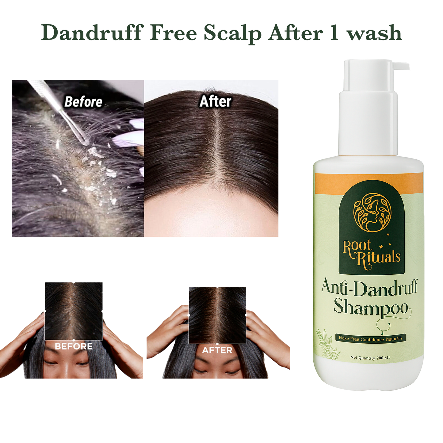 RootRituals Anti dandruff Shampoo with Tea Tree & Zinc.