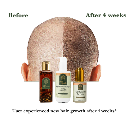 Root Rituals Hair Growth Kit | hair Oil, Shampoo & Serum Combo