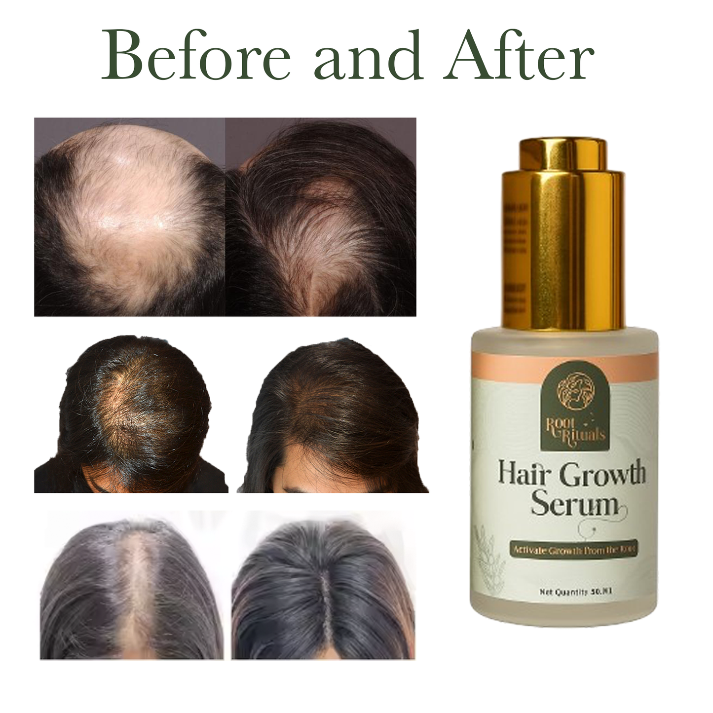 Root Rituals Hair Growth Serum and Reduce Hair Fall.