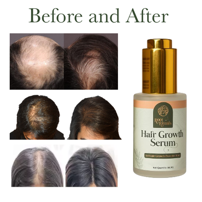 Root Rituals Hair Growth Serum and Reduce Hair Fall.