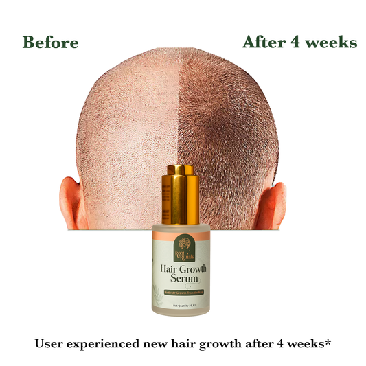 Root Rituals Hair Growth Serum and Reduce Hair Fall.