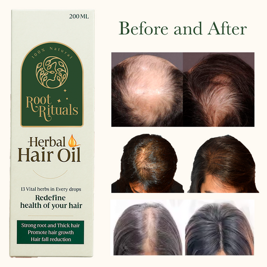 RootRituals Jadibuti Hair Oil for Men & Women, Promote hair growth and reduces hairfall - 200ml